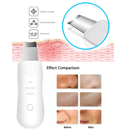 Ultrasonic Skin Scrubber