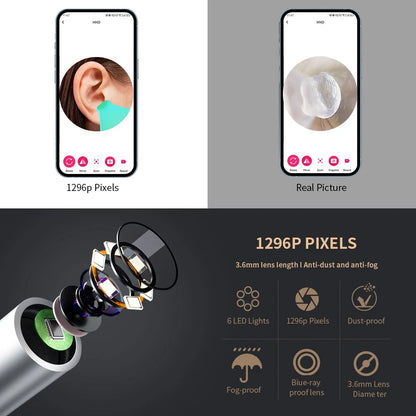 Smart Visual Ear Cleaner